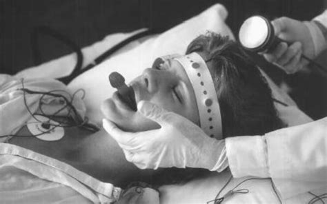 Electroconvulsive Therapy