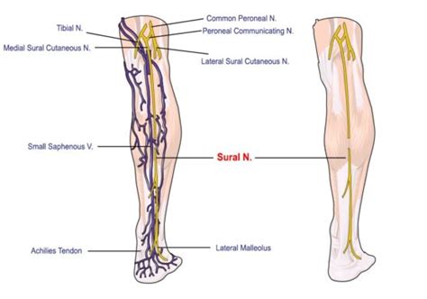 Sural Nerve The Pain In Your Legs May Not Be Caused By Your Back