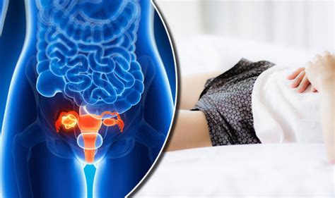 Ovarian Cancer Breakthrough Scientists Discover How The Deadly Cancer