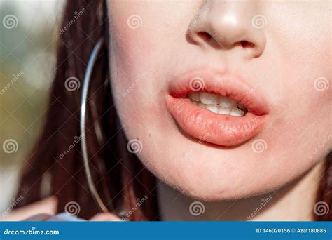 Woman Removes Lipstick From Lips Outdoors Stock Photo Image Of Macro