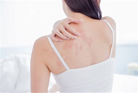 Chronic Dry Skin Causes And Treatments Reviewthis