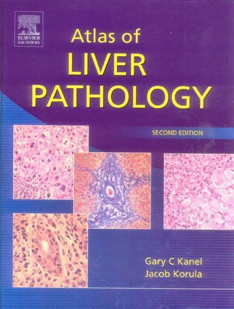 Atlas Of Liver Pathology 2nd Edition Booksmedicos