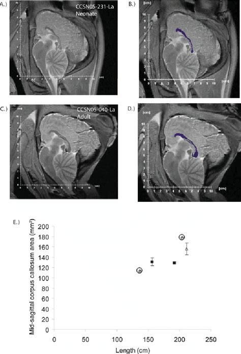 Segmentation Label Maps And Mid Sagittal Areas Of The Corpus Callosum Download Scientific