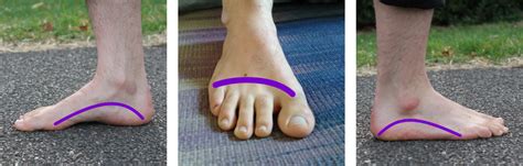Foot Posture And Alignment Massage And Movement