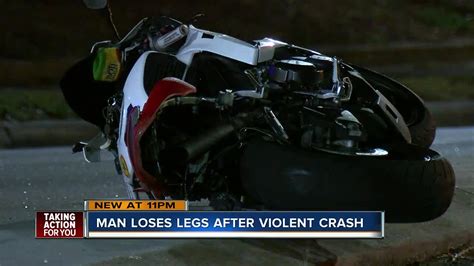 Police Motorcyclist Loses Both Legs After Hit And Run