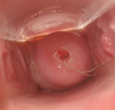 Cervix During Orgasm Xxgasm