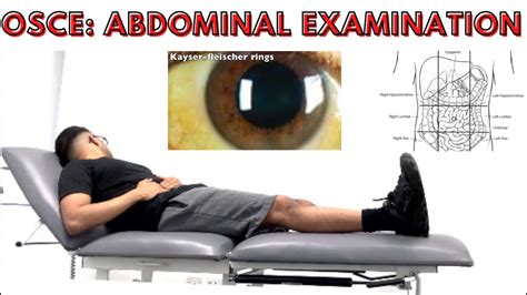 Osce Abdominal Examination Youtube