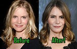 Jennifer Jason Leigh: Plastic Surgery Modifies Her Face. Before-After ...
