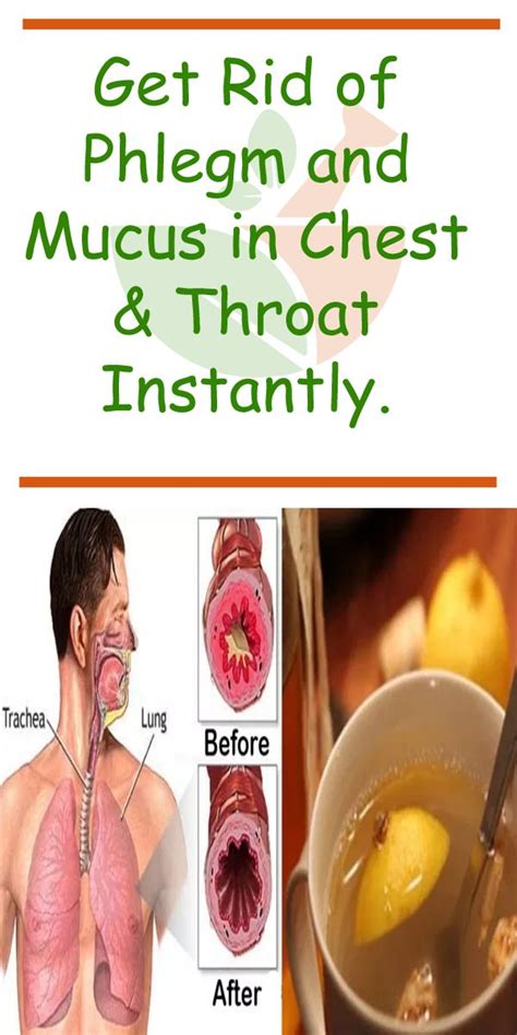 Get Rid Of Phlegm And Mucus In Chest And Throat Instantly Getting Rid