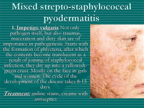 Pyoderma And Scabies презентация онлайн