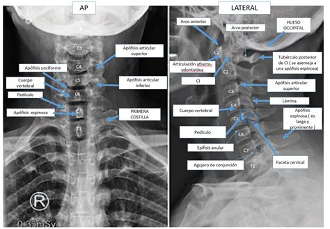 Anatomía de la columna cervical Dolopedia