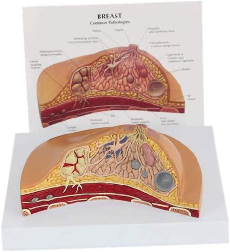Human Breast Pathology Breast Anatomy Model Breast Augmentation Beauty Model