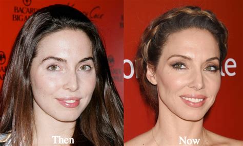 whitney cummings plastic surgery before and after photos latest plastic surgery gossip and