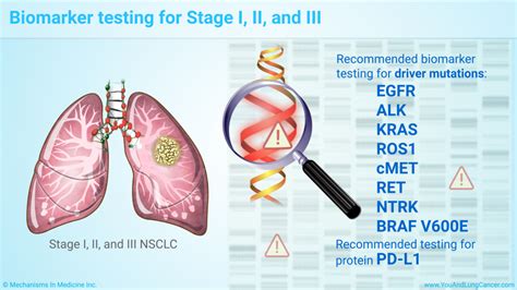 Slide Show Targeted Therapy In Non Small Cell Lung Cancer