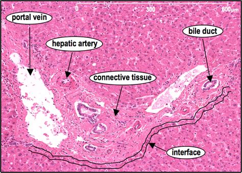 Histology Slides Bile Duct Triad Arteries Liver Portal Diagram The