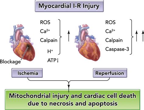 Cellular Events Leading To Ischemia Reperfusion Injury In The Heart