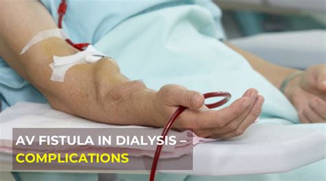 Arteriovenous Fistula Access For Dialysis Mumbai India Dr Jathin S Vein Center