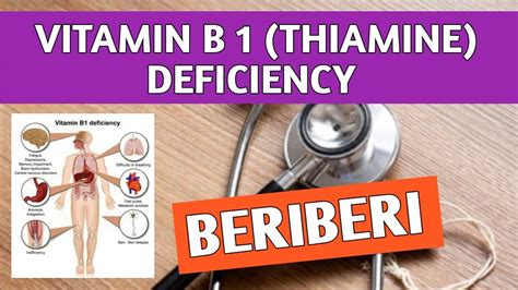 Beriberi Vitamin B1 Thiamine Deficiency Dietary Sources Causes