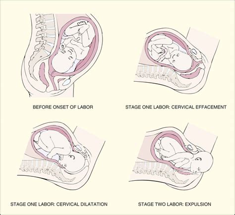 Labor Delivery And Postpartum Basicmedical Key