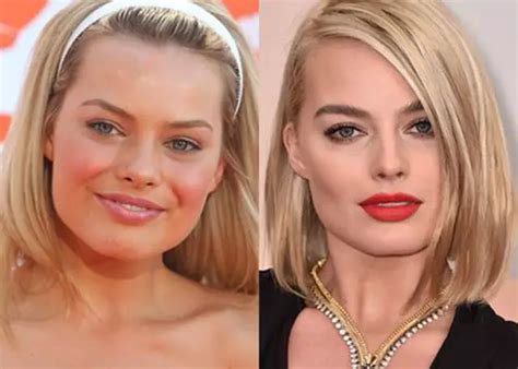 Margot Robbie Plastic Surgery Before And After Celebie
