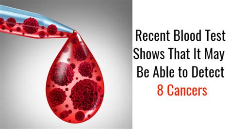 Recent Blood Test Shows That It May Be Able To Detect 8 Cancers