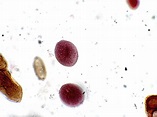 Balantidium coli – Cyst – Parasitology