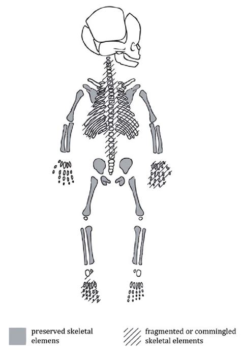 Preservation Of Skeletal Elements Of The Studied Invididual Inv No A