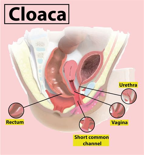 Cloaca Isacommon Aperture For Digestive And Urinary Systemsbcommon Aperture For Digestive