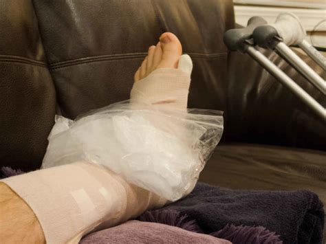 Crushed Foot Injury Compensation Key Points On Claiming