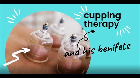 What Is Cupping The Effects And Benefits Youtube