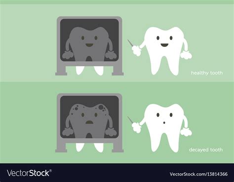 Tooth Dentist X Ray Healthy And Unhealthy Teeth Vector Image