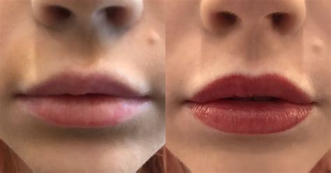 Permanent Lip Color Tattoo Experience Photos