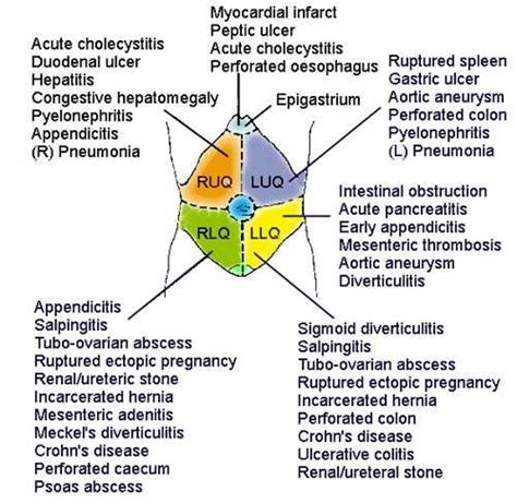 Acute Abdominal Pain Acute Abdomen Information Patient