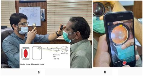 A Positioning Of Examiner With 20d Lens In One Hand And Smartphone With