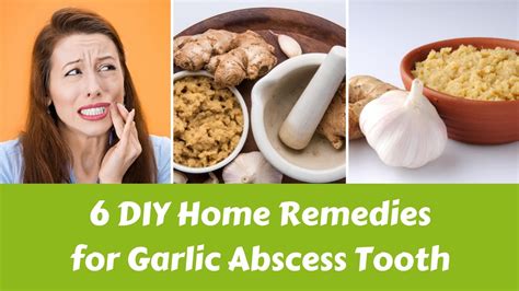 6 Diy Home Remedies For Garlic Abscess Tooth Youtube