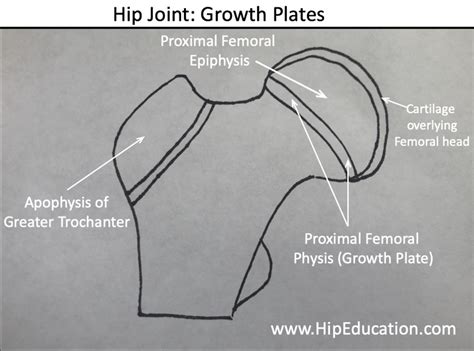 Slipped Capital Femoral Epiphysis Hipeducation