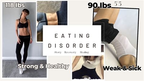 My Eating Disorder Story Anorexia Nervosa Bulimia Recovery Healing Vulnerable Detailed