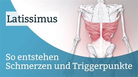 Latissimus Schmerzen Triggerpunkte Und Deren Aktivierung Youtube