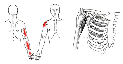 The Trigger Point And Referred Pain Guide 16