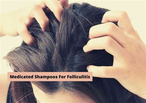 The 4 Best Shampoo For Folliculitis 2022 For A Clean Healthy Scalp