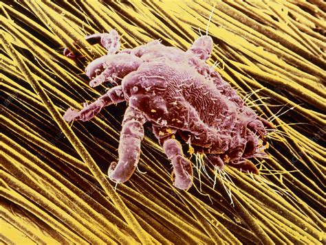 Coloured Sem Of Pubic Louse On Pubic Hair Stock Image Z