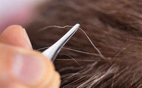 Does Plucking White Hair Lead To More Greying Skinkraft
