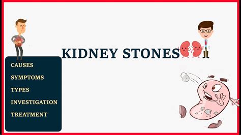 Kidney Stone Causes Types Symptoms Treatment Youtube