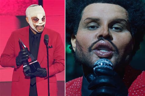 Canadian Singer The Weeknd Shows Off New Grotesque Look In Music Video