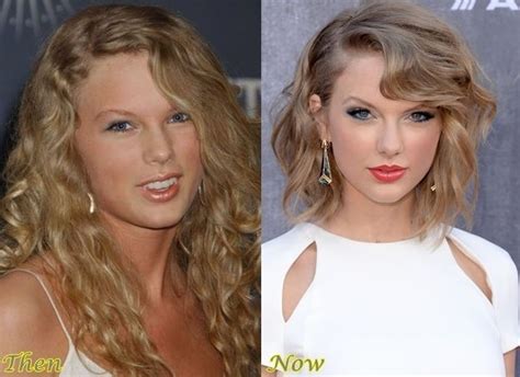 Taylor Swift Before And After Plastic Surgery Celebrity Plastic Surgery Online