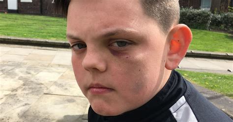 Mum Slams School S Bullying Problem After Son 13 Hit From Behind And Stamped On In Vicious