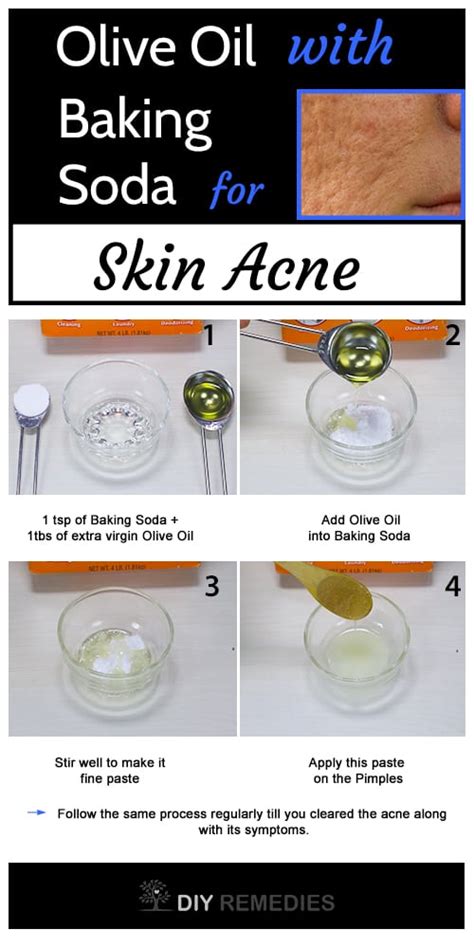 How To Get Rid Of Acne With Olive Oil