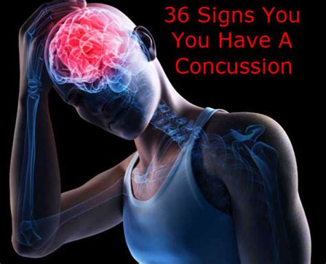 Signs You Have A Concussion — Info You Should Know