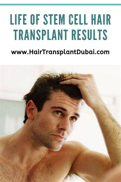 How Long Will A Stem Cell Hair Transplant Last Hair Transplant Stem Cells Hair Stem Cell
