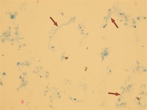 Mucus Microscopic Analysis Of Urine Faculty Of Medicine Masaryk